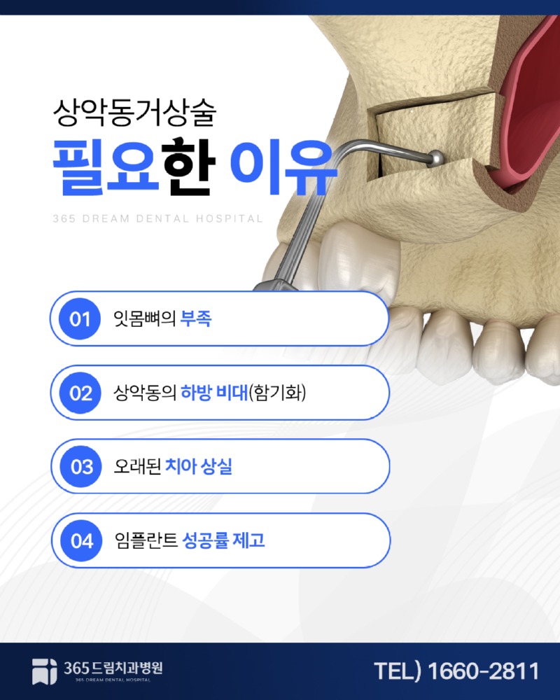 망미동 상악동거상술 블로그_3.jpg