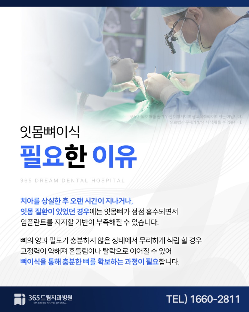 대연동 잇몸뼈이식 블로그_2.jpg