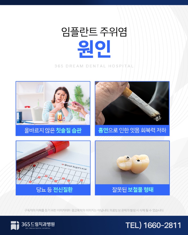 용호동 임플란트주위염 블로그_2.jpg