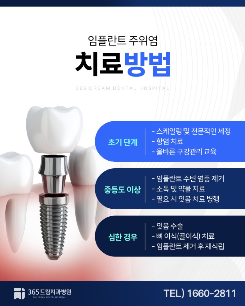 용호동 임플란트주위염 블로그_4.jpg