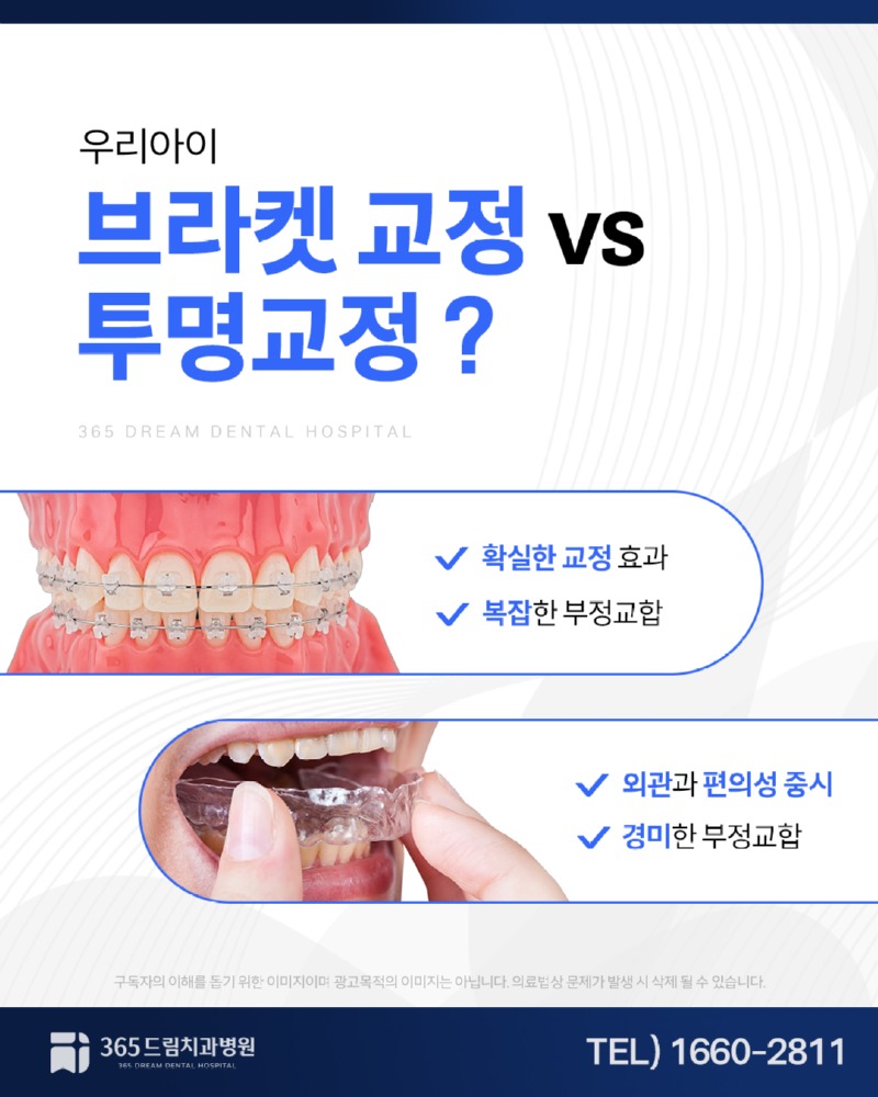 남천동 중학생치아교정 블로그_4.jpg