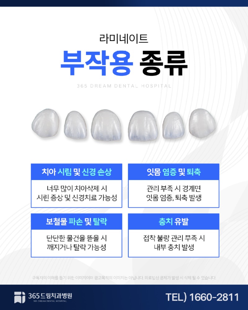 광안동 라미네이트 블로그_4.jpg