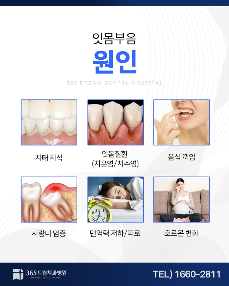 수영구 잇몸치과 블로그_2.jpg