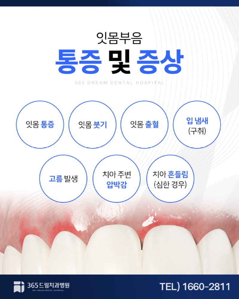 수영구 잇몸치과 블로그_3.jpg