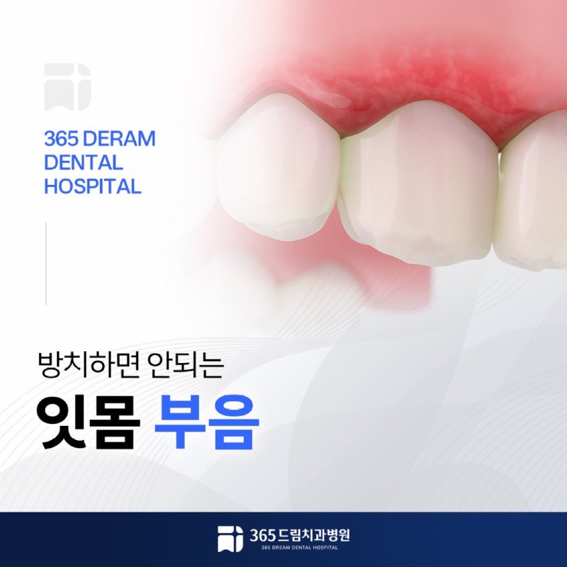 수영구 잇몸치과 썸네일_1.jpg