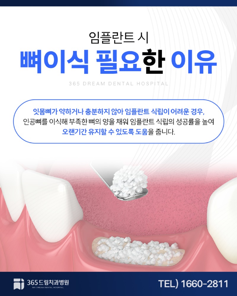 해운대 임플란트 블로그_2.jpg