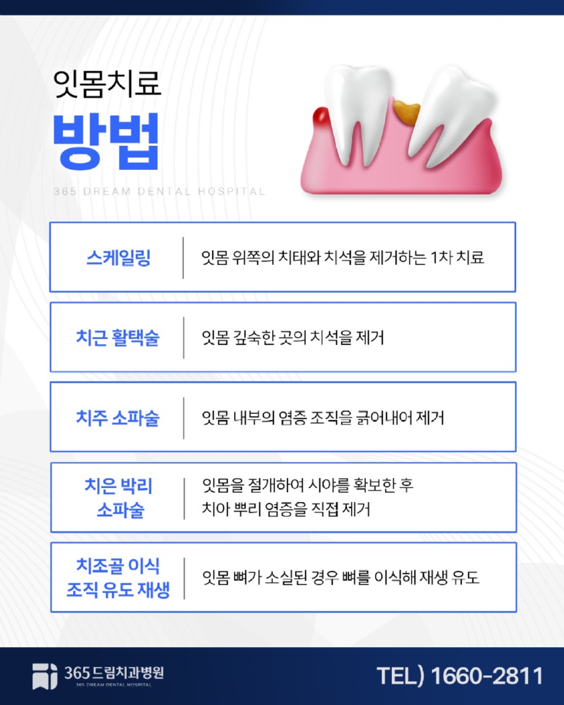 안락동 잇몸치료 블로그_3.jpg