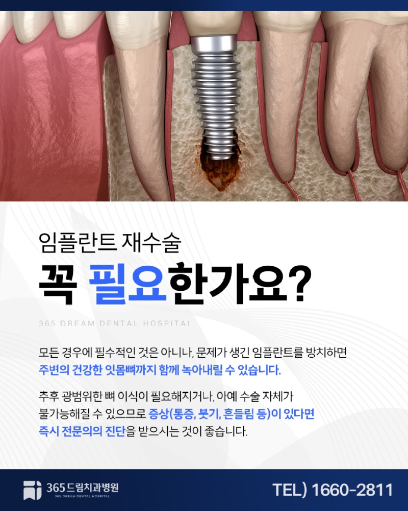 좌동 임플란트수술 블로그_3.jpg