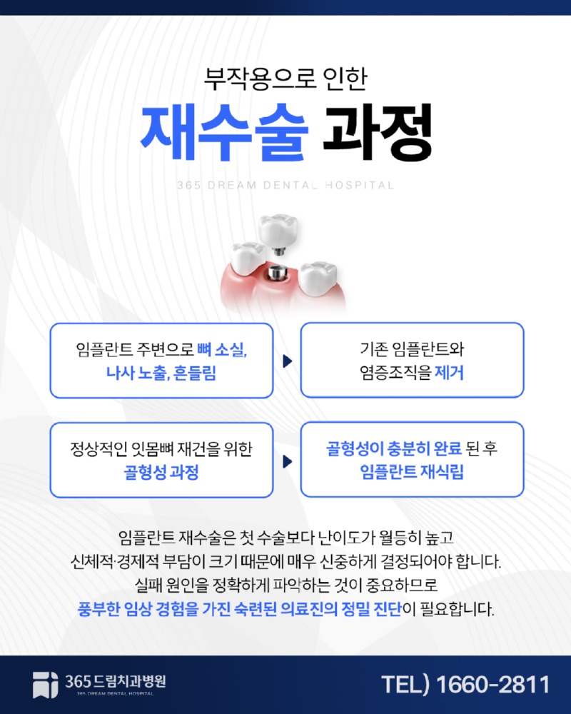 좌동 임플란트수술 블로그_4.jpg