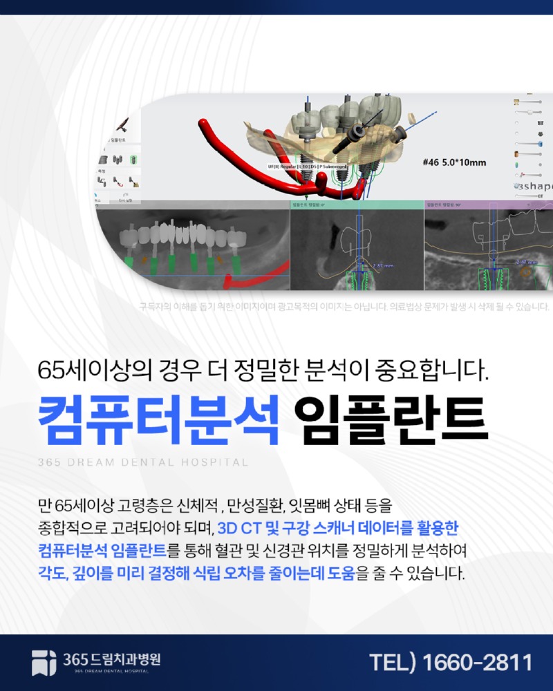 수영구 임플란트 블로그_4.jpg