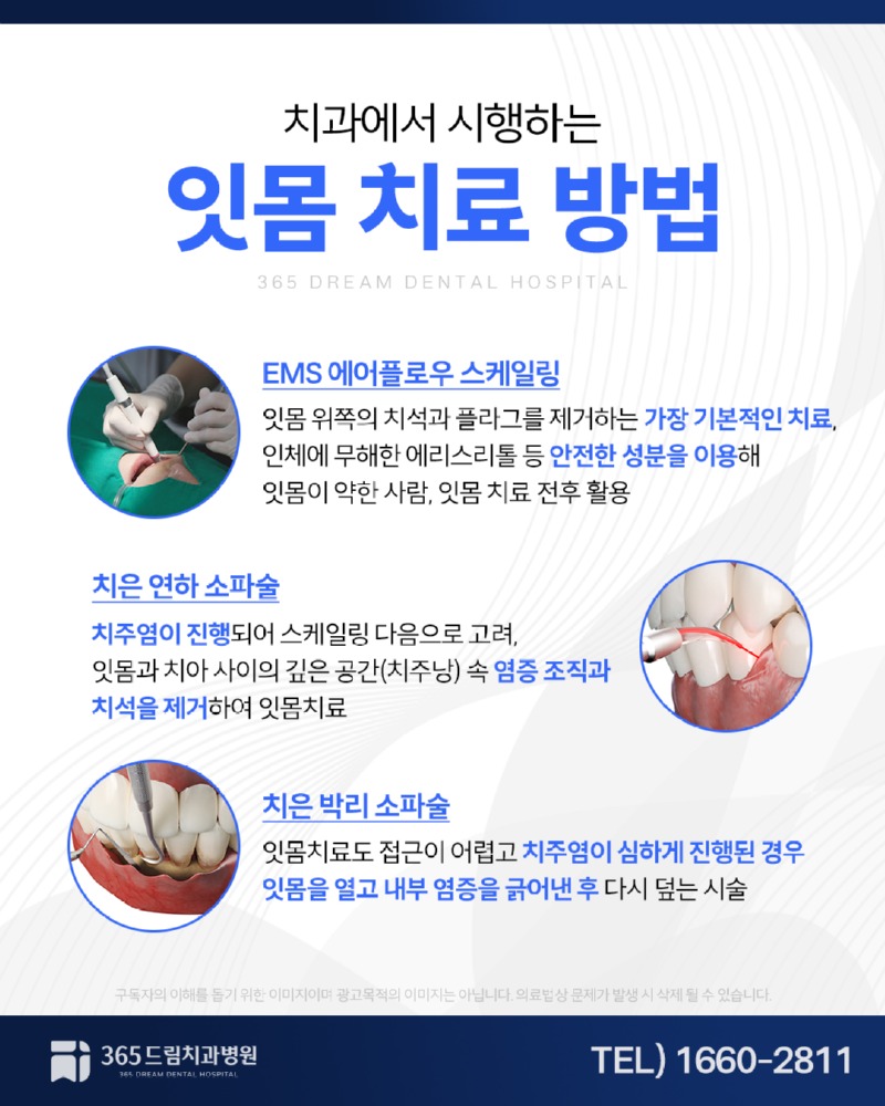반여동 잇몸치료 블로그_4.jpg