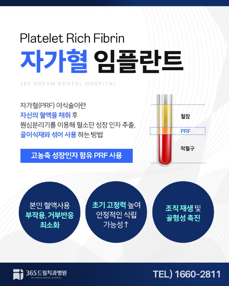 재송동 임플란트 블로그_2.jpg