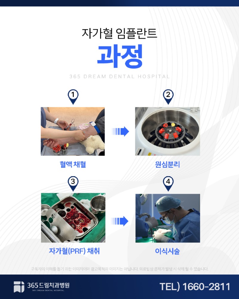 재송동 임플란트 블로그_4.jpg