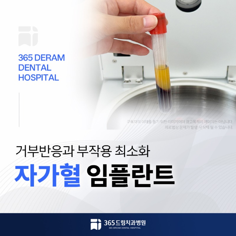 재송동 임플란트 썸네일_1.jpg