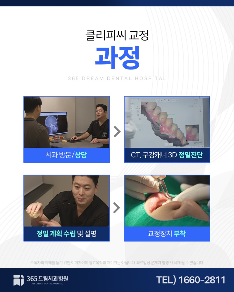 광안동 치아교정 블로그_4.jpg