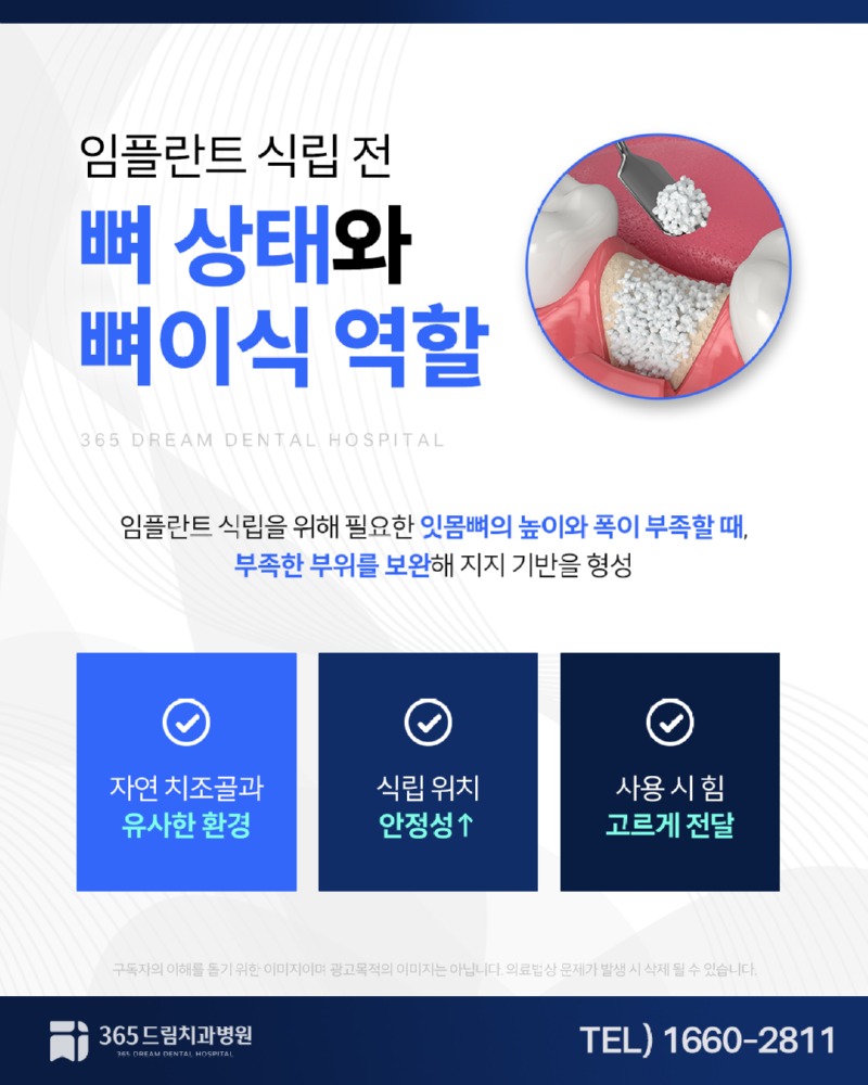 센텀 임플란트 블로그_2.jpg