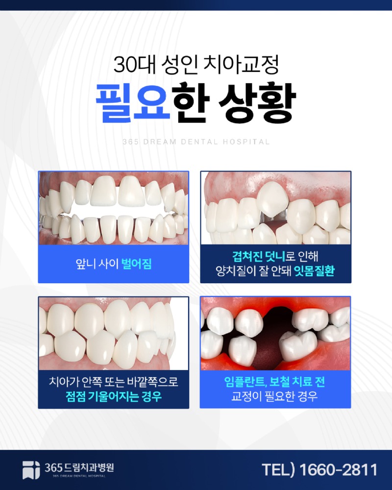 부산 수영역치과 블로그_1.jpg