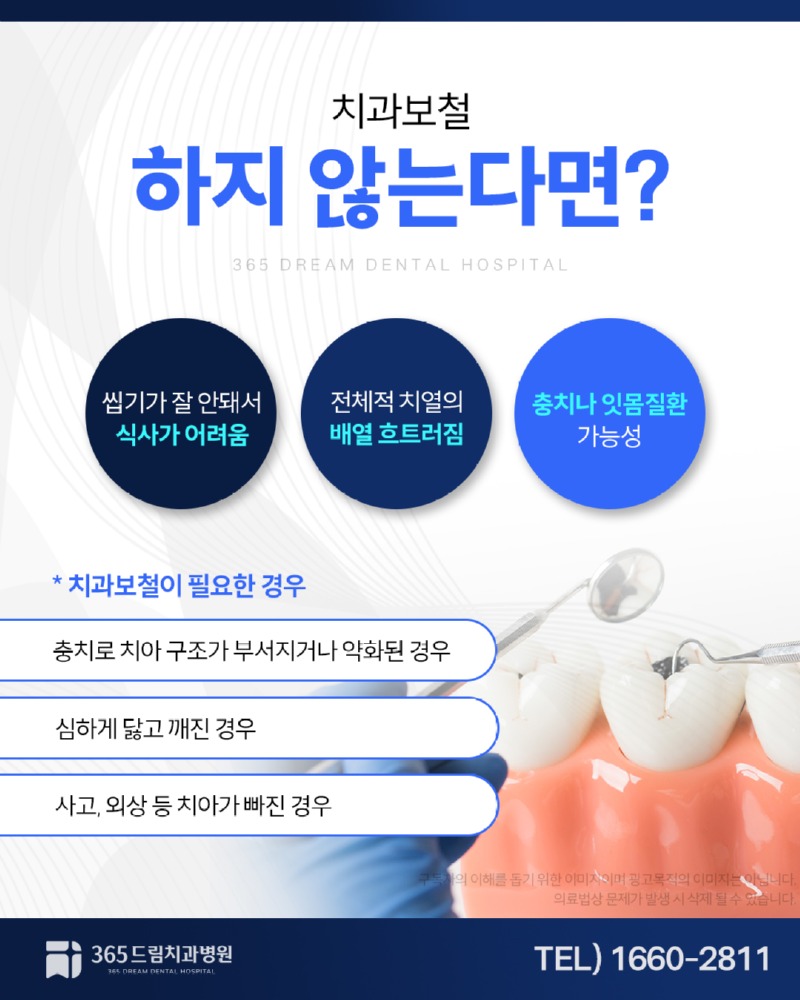 부산보철치과 블로그_3.jpg