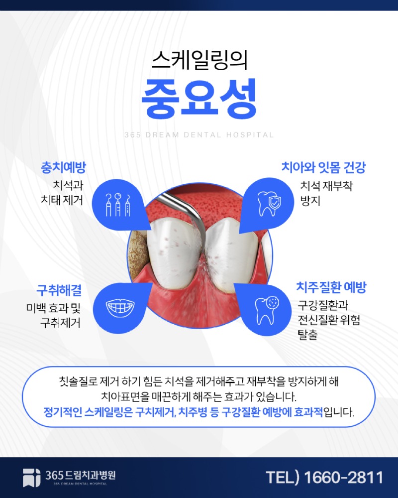 수영스케일링 블로그_2.jpg