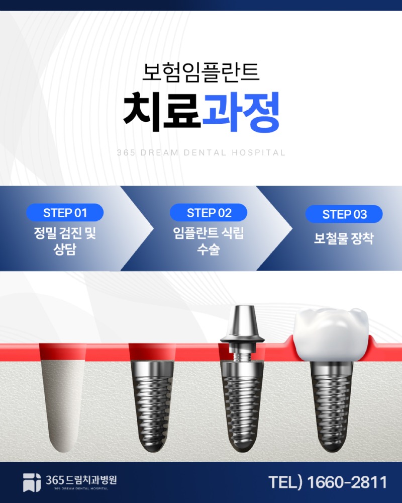 부산보험임플란트 블로그_4.jpg