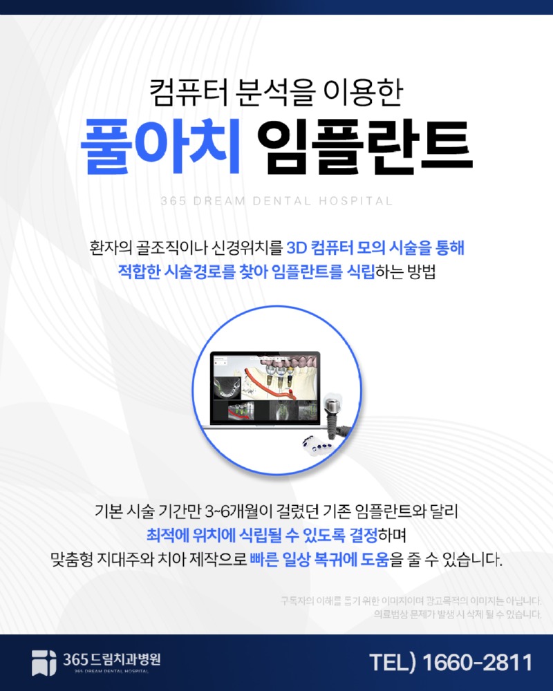 부산풀아치임플란트 블로그_4.jpg