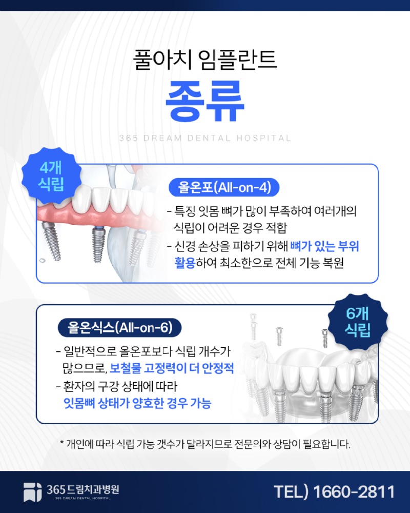 부산풀아치임플란트 블로그_3.jpg