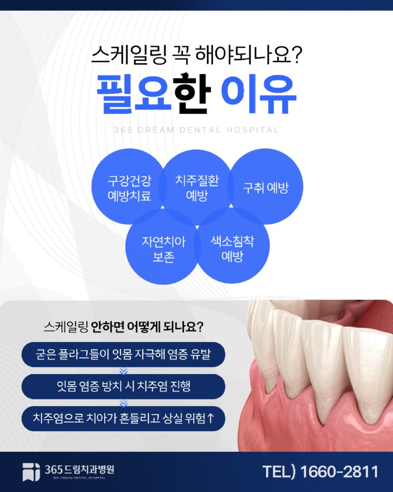 부산스케일링 블로그_2.jpg