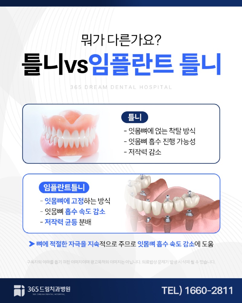 부산임플란트틀니 블로그_3.jpg