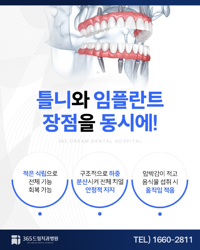 부산임플란트틀니 블로그_4.jpg