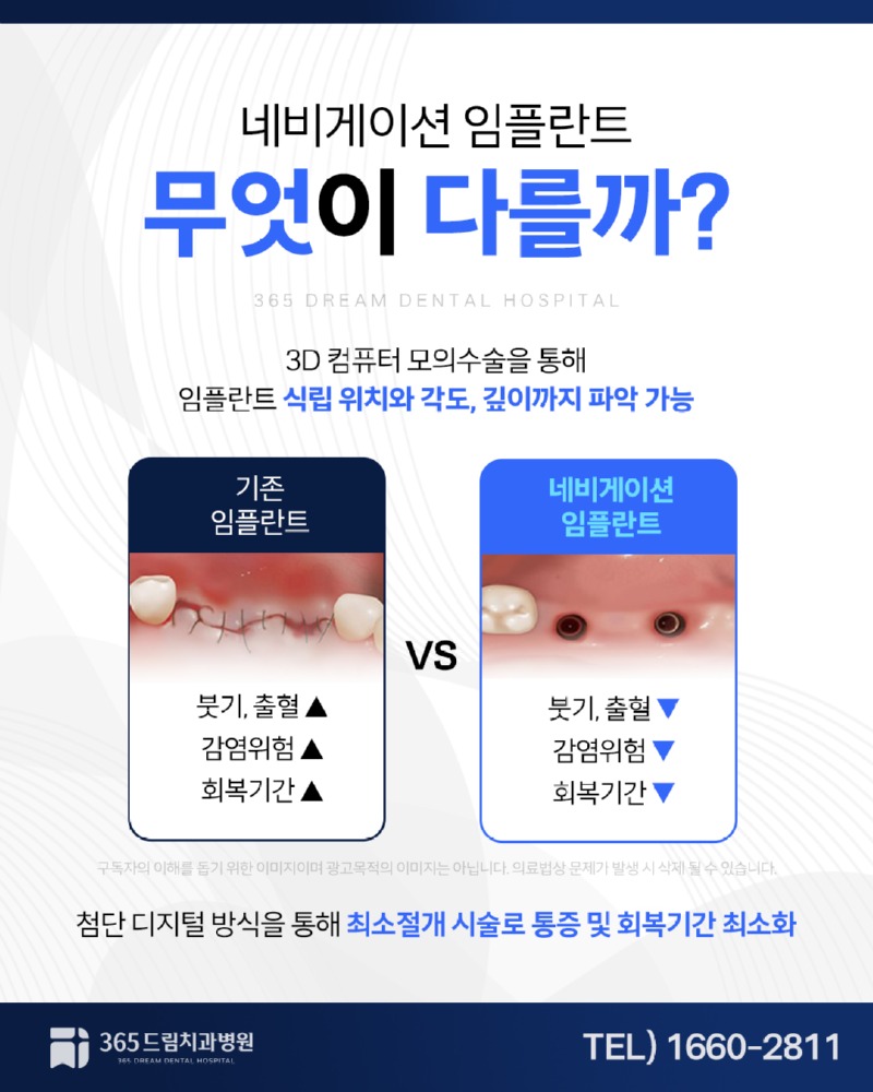부산네비게이션임플란트 블로그_2.jpg