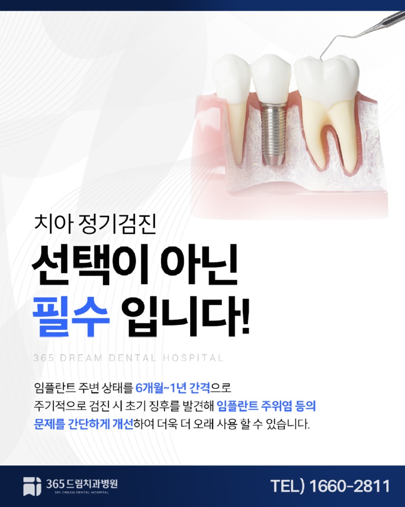 부산네비게이션임플란트 블로그_5.jpg