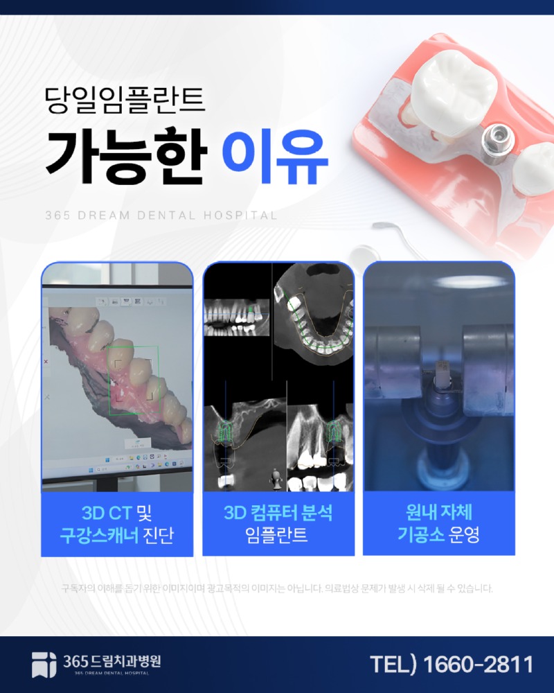 부산당일임플란트 블로그_4.jpg