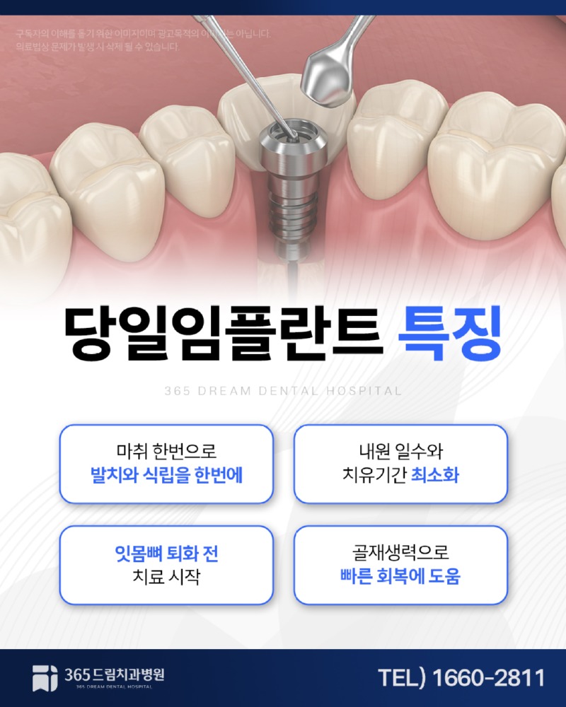 부산당일임플란트 블로그_3.jpg