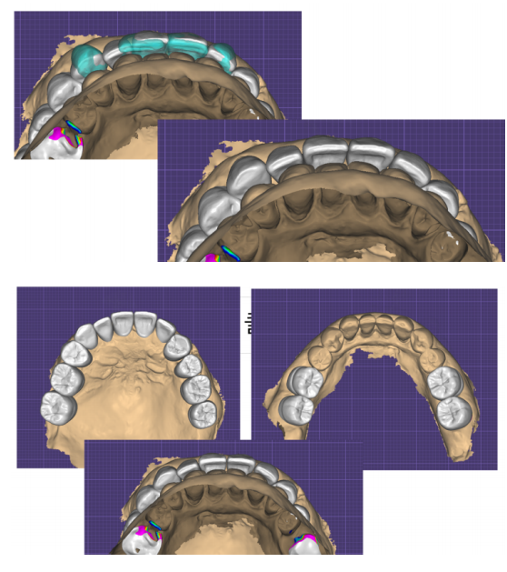 6.png