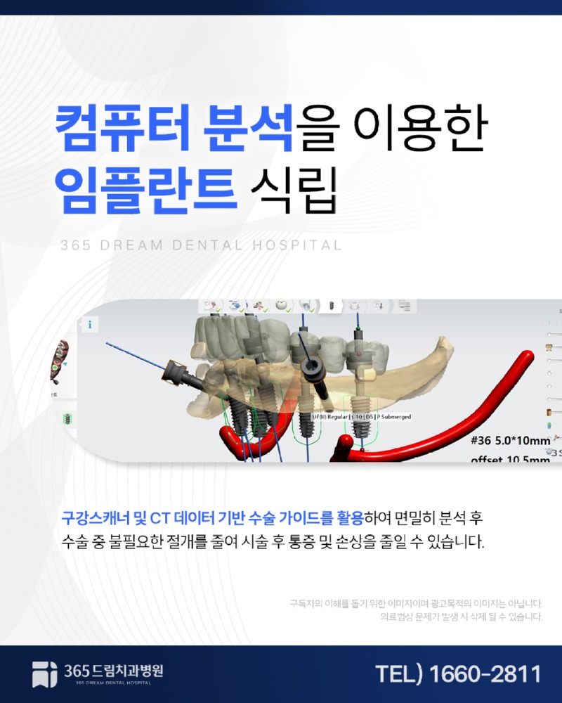 부산전체임플란트_4.jpg