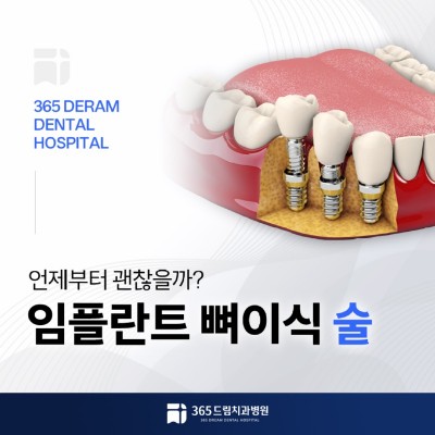 해운대 임플란트 썸네일_1.jpg