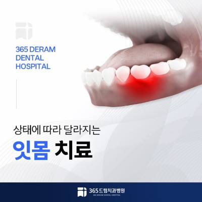 안락동 잇몸치료 썸네일_1.jpg