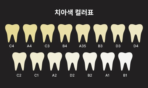 치아색 컬러표.jpg
