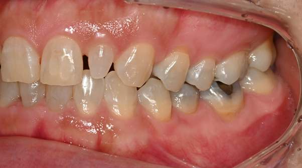 2_구강  내 전(2).png