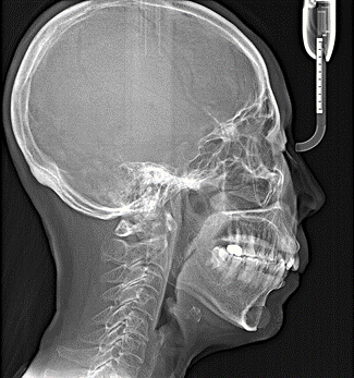 13_X-RAY 전(1).png