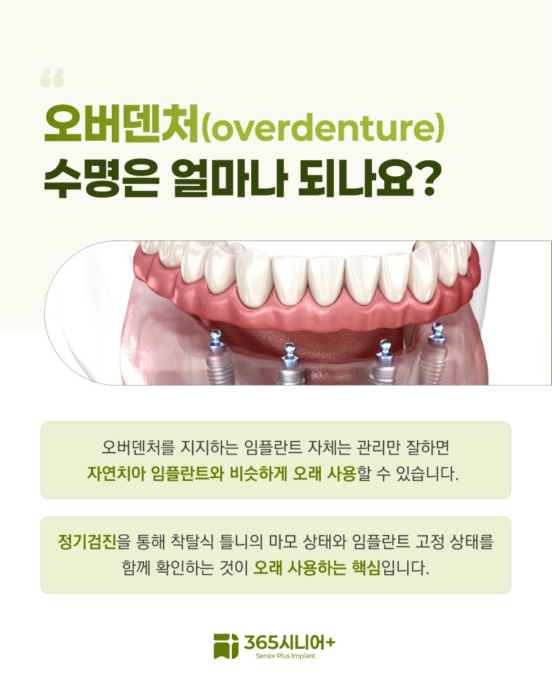 시니어임플란트 브랜드 블로그 틀니와오버덴처임플란트선택_1 사본 10.jpg
