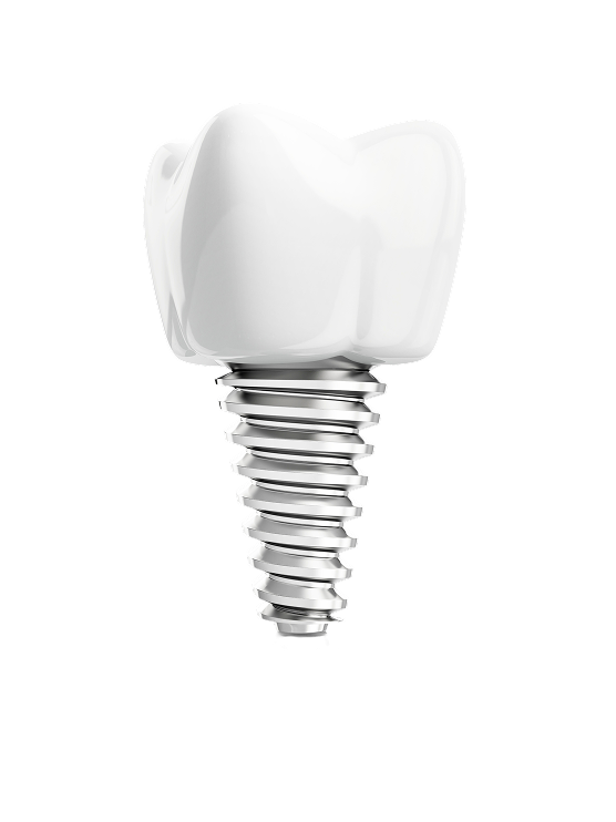 senior_repeat_image_implant